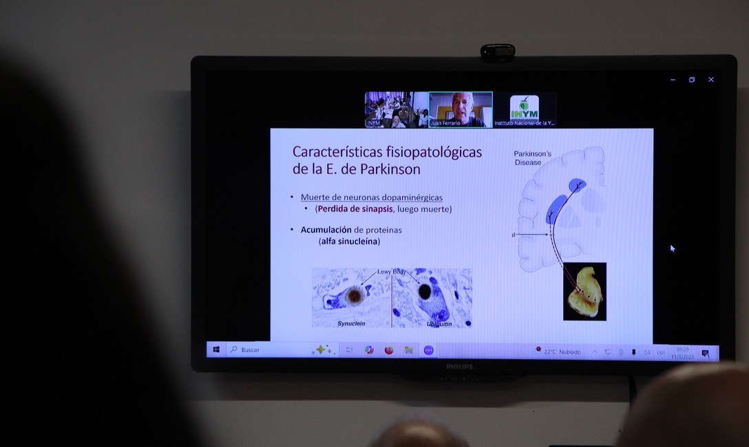 Imagen de El Mate previene el Parkinson, una enfermedad en aumento en el mundo Imagen de El Mate previene el Parkinson, una enfermedad en aumento en el mundo